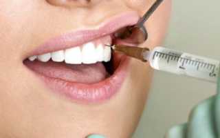 Болит место укола после лечения зуба