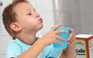 Чем лечить язвы во рту у ребенка