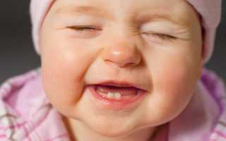 Когда лезут зубы у ребенка симптомы