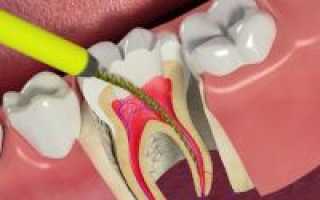Зуб без нерва сколько живет