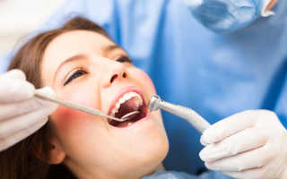 Как стоматологи лечат кариес