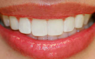 Идеальная форма зубов