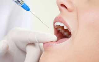 Больно ли делать имплантацию зубов