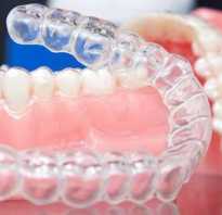 Что такое каппа в стоматологии