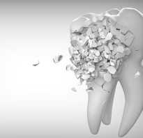 Имплантация зубной эмали