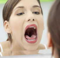 Как вылечить болячку во рту