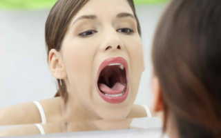 Как избавиться от язвочек во рту
