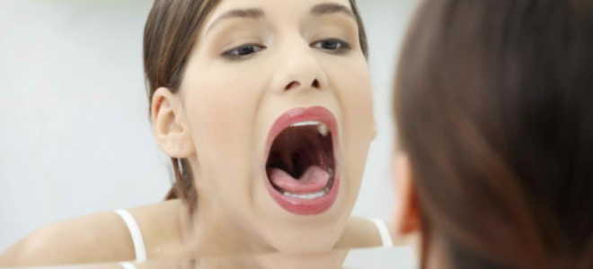 Как вылечить болячку во рту