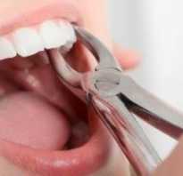 Как чистить зубы после удаления