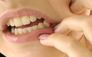 Что делать если чешутся зубы