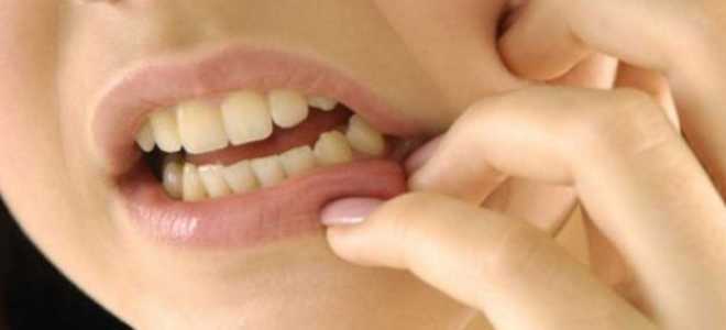 Чешутся зубы при беременности