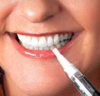 Как пользоваться отбеливателем для зубов
