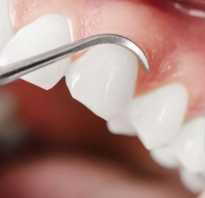 Воспаление десны около зуба лечение антибиотиками