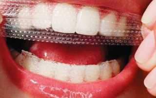 Отбеливающие полоски на зубы