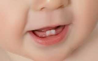 Во сколько прорезаются первые зубы у детей