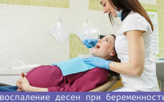 Как лечить воспаление десен при беременности