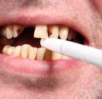 Зубы после курения