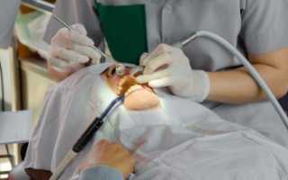 Ультразвук в стоматологии противопоказания