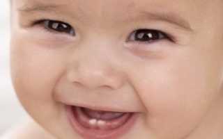 Во сколько у ребенка вылезает первый зуб