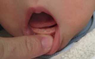 Сколько растут зубы у младенцев