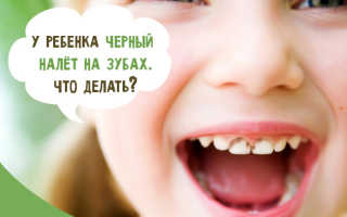 Почему чернеют зубы у годовалого ребенка