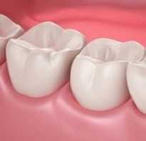 Как лечить десна зубов
