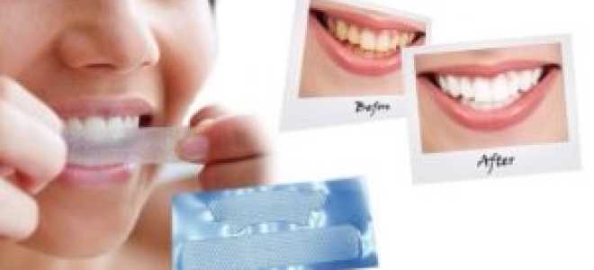 Как использовать полоски для отбеливания зубов