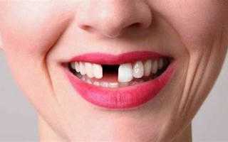 Удаление передних нижних зубов