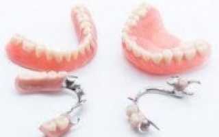 Имплантация или протезирование зубов