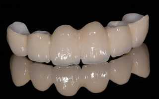 Современные коронки на зубы