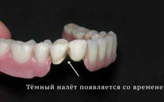 Чем отбелить пластмассовые зубные протезы