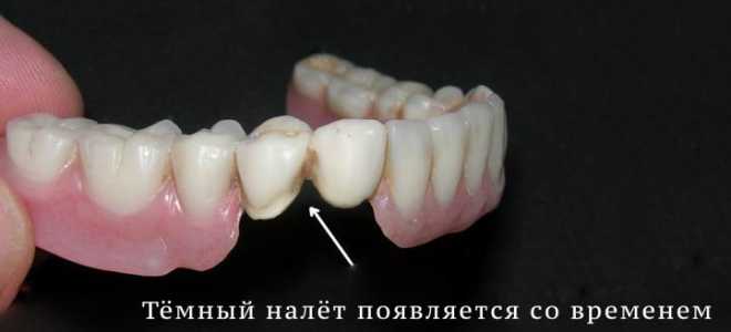 Как очистить зубные протезы от черноты