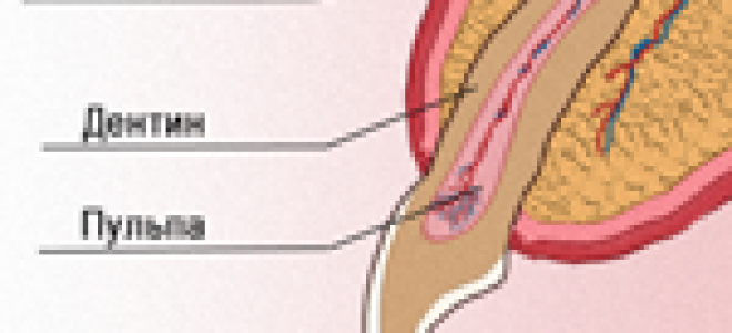 Операция резекции верхушки корня