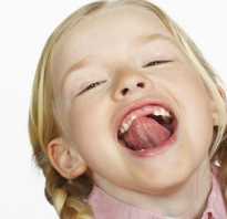 Подрезание уздечки под языком у детей лазером