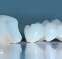 Коронки для зубов цирконий