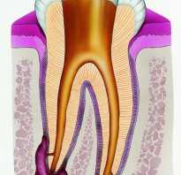 Межкорневая киста зуба лечение