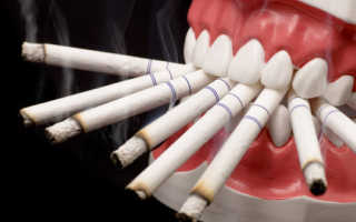 Можно ли курить после удаления зуба мудрости
