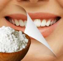Отбеливание зубов с помощью соды