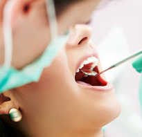 Временный зубной протез на передние зубы