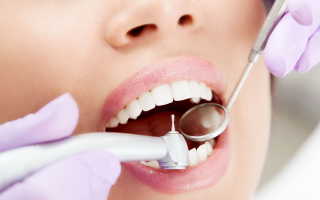Как делают протезирование зубов