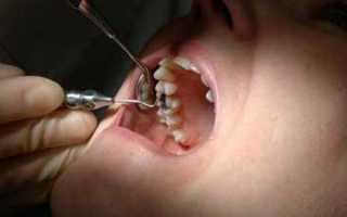 Боль при удалении зуба