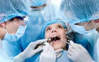 Что такое имплантант зуба