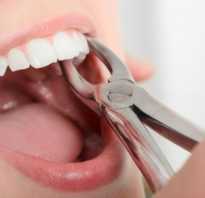 Гигиена после удаления зуба