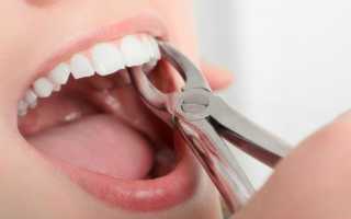 Гигиена после удаления зуба