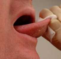 Травма языка зубами лечение