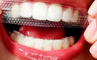 Отбеливающие полоски для зубов как пользоваться