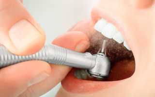 Какой стоматолог ставит пломбы