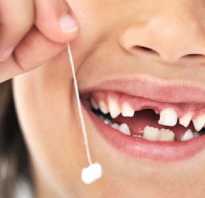 Как безболезненно вырвать зуб в домашних условиях