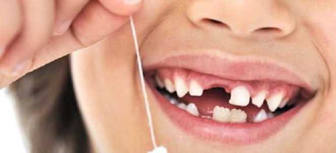 Как безболезненно вырвать зуб в домашних условиях