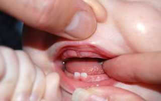 Как пережить прорезывание зубов у ребенка